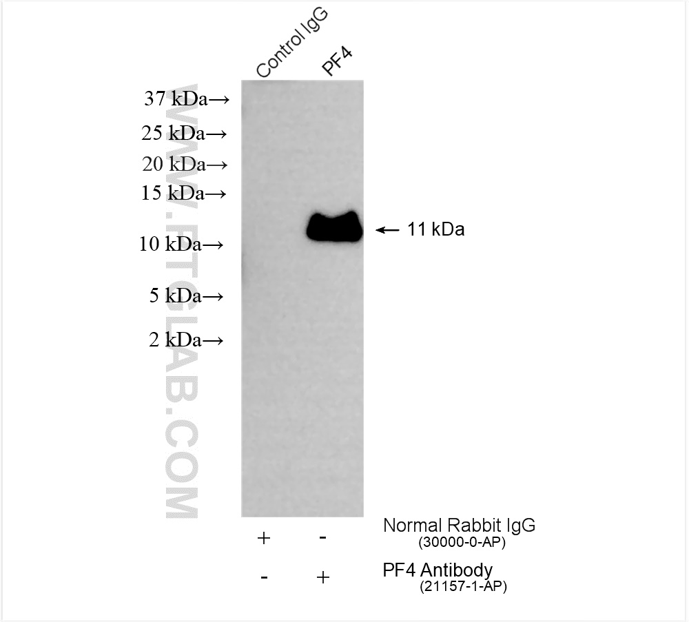 Immunoprecipitation (IP) experiment of mouse serum using PF4 Polyclonal antibody (21157-1-AP)