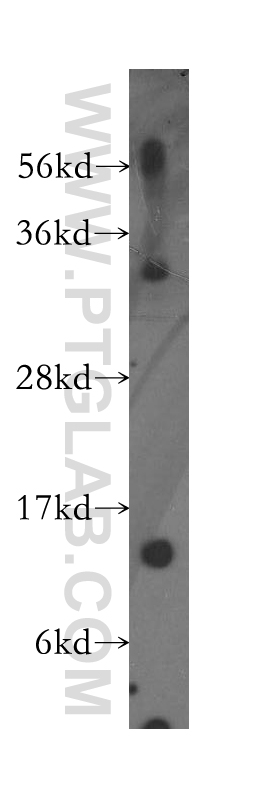 Western Blot (WB) analysis of human colon tissue using PFDN1 Polyclonal antibody (11033-2-AP)