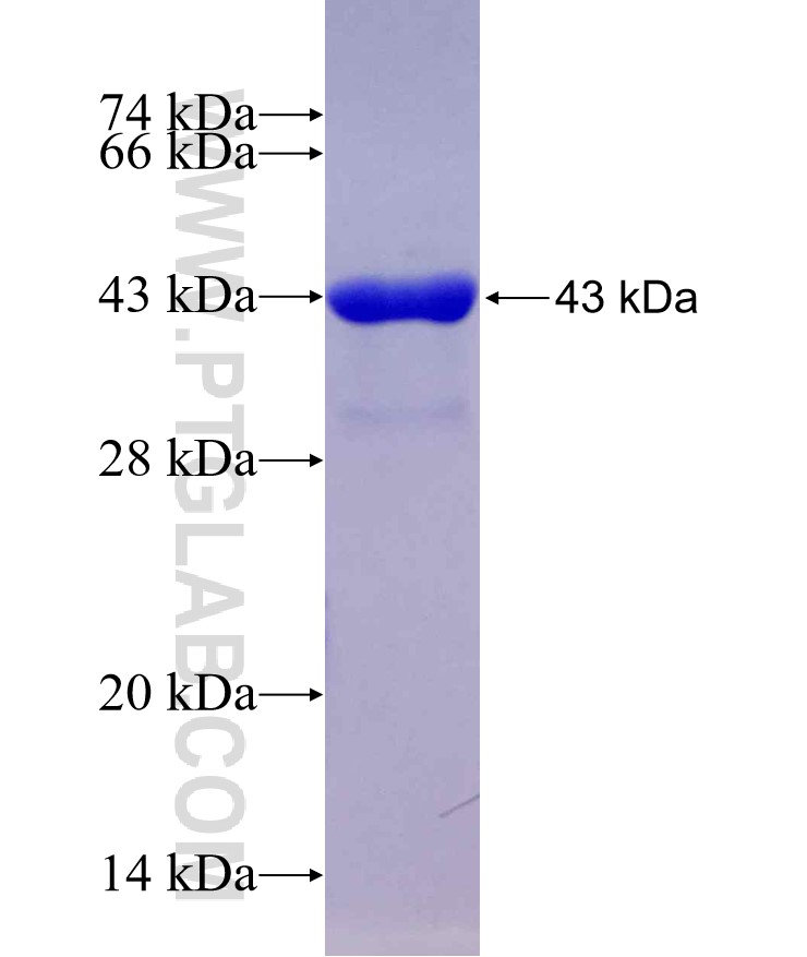 PFDN1 fusion protein Ag1506 SDS-PAGE