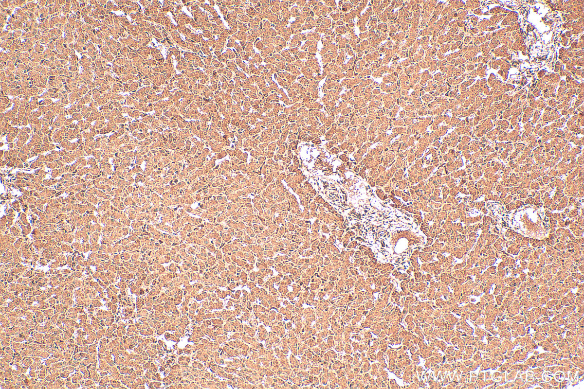 Immunohistochemistry (IHC) staining of human liver tissue using PFKFB3 Polyclonal antibody (13763-1-AP)