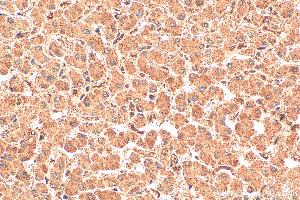 Immunohistochemistry (IHC) staining of human liver tissue using PFKFB3 Polyclonal antibody (13763-1-AP)
