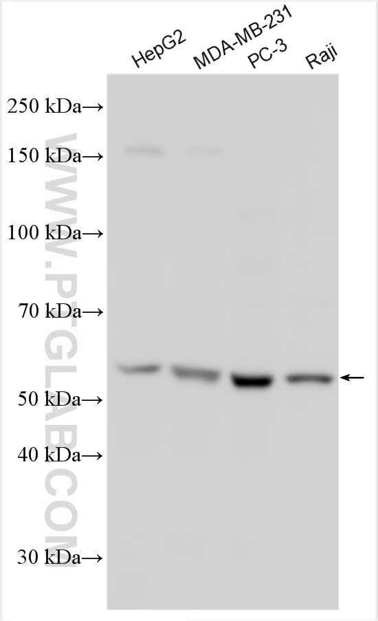 Western Blot (WB) analysis of various lysates using PFKFB4 Polyclonal antibody (29902-1-AP)