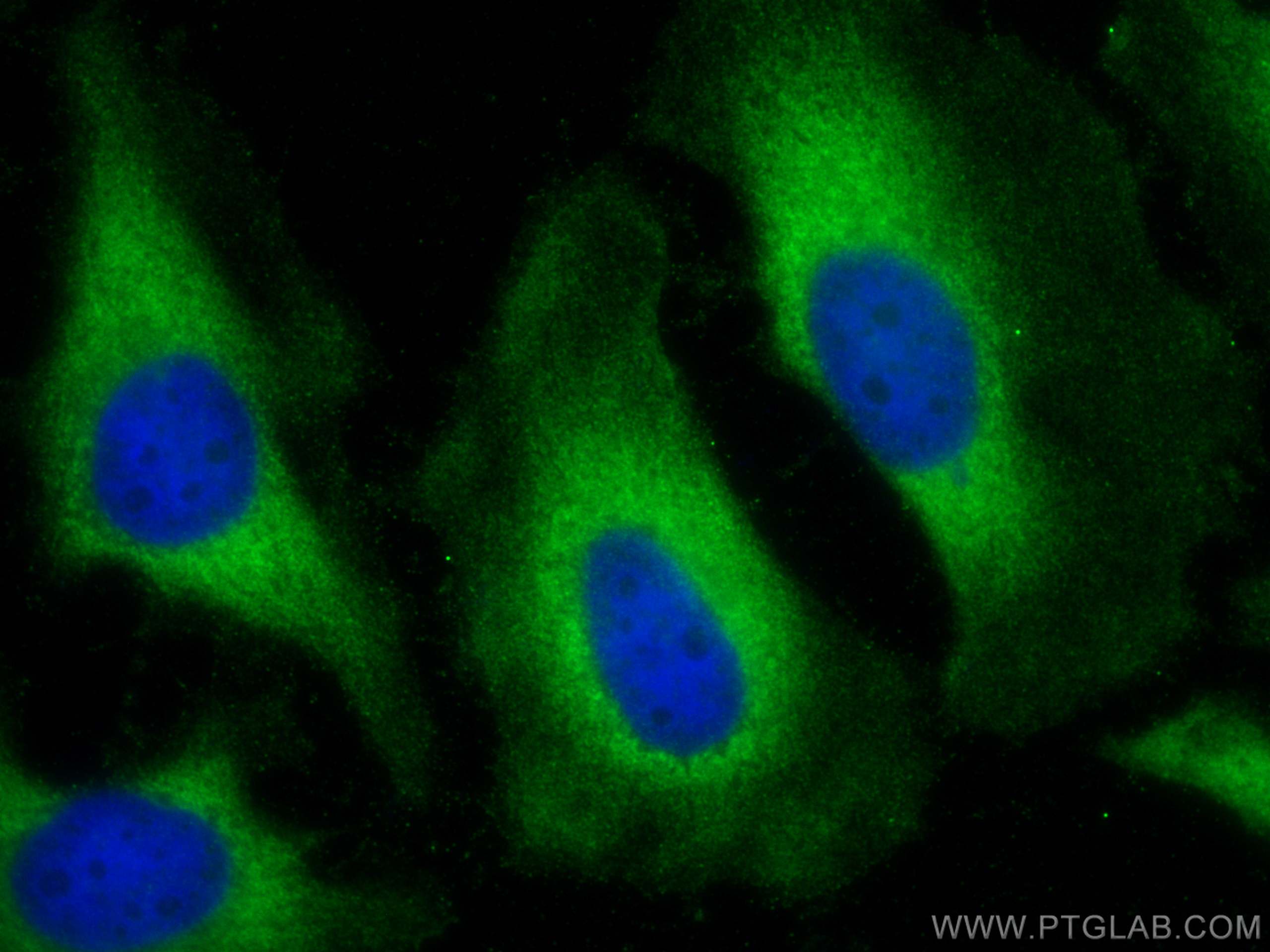 Immunofluorescence (IF) / fluorescent staining of HeLa cells using PFKM Polyclonal antibody (55028-1-AP)