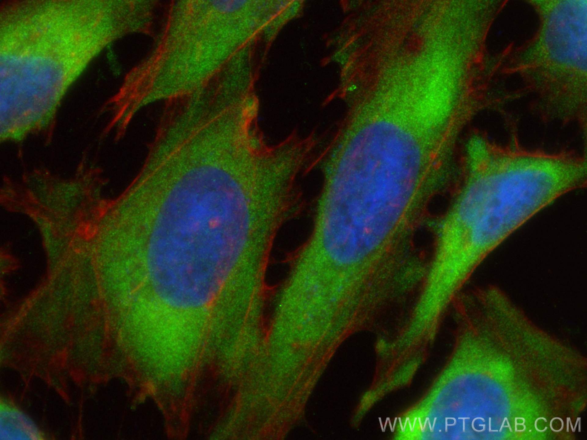 Immunofluorescence (IF) / fluorescent staining of HeLa cells using PFKM Polyclonal antibody (55028-1-AP)