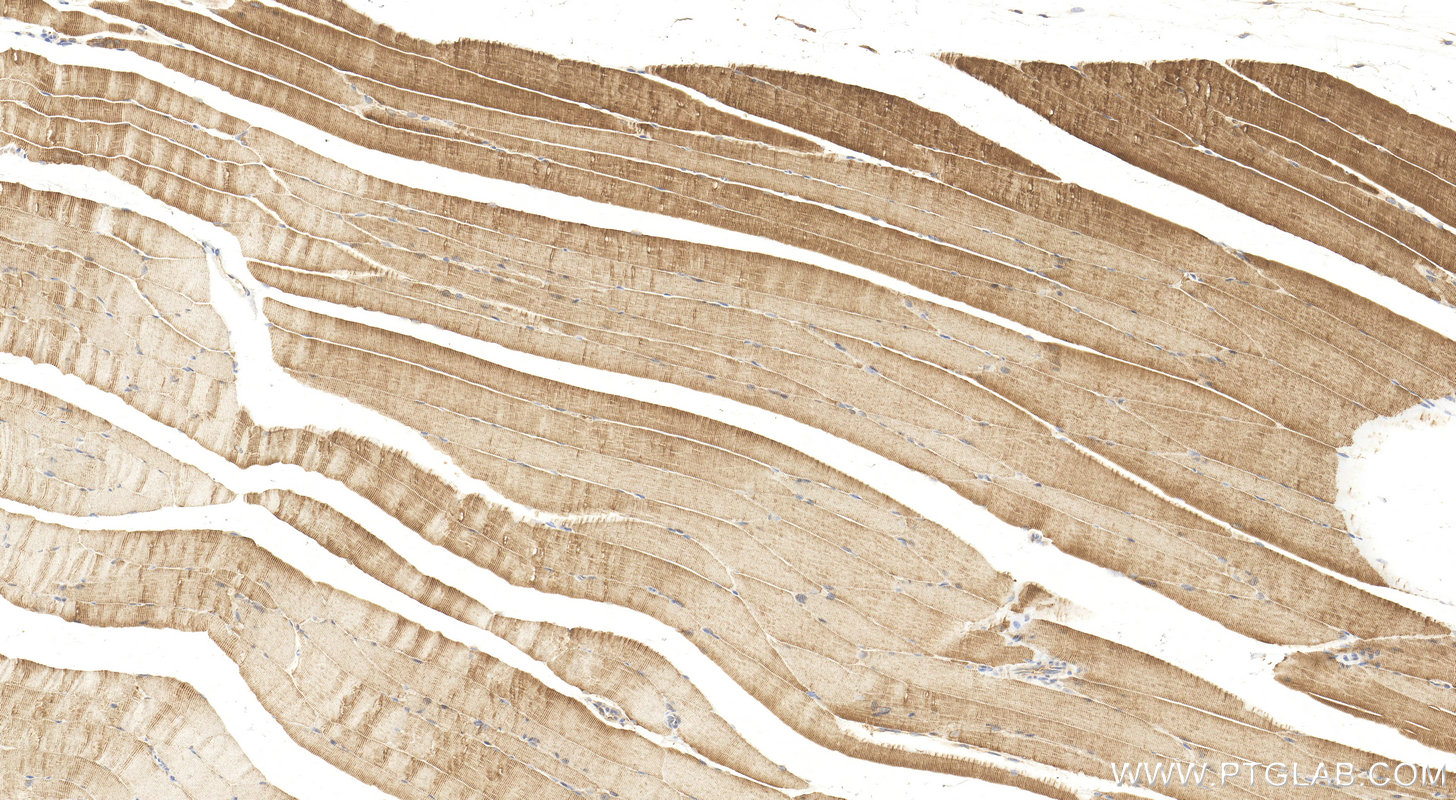 Immunohistochemistry (IHC) staining of mouse skeletal muscle tissue using PFKM Polyclonal antibody (55028-1-AP)