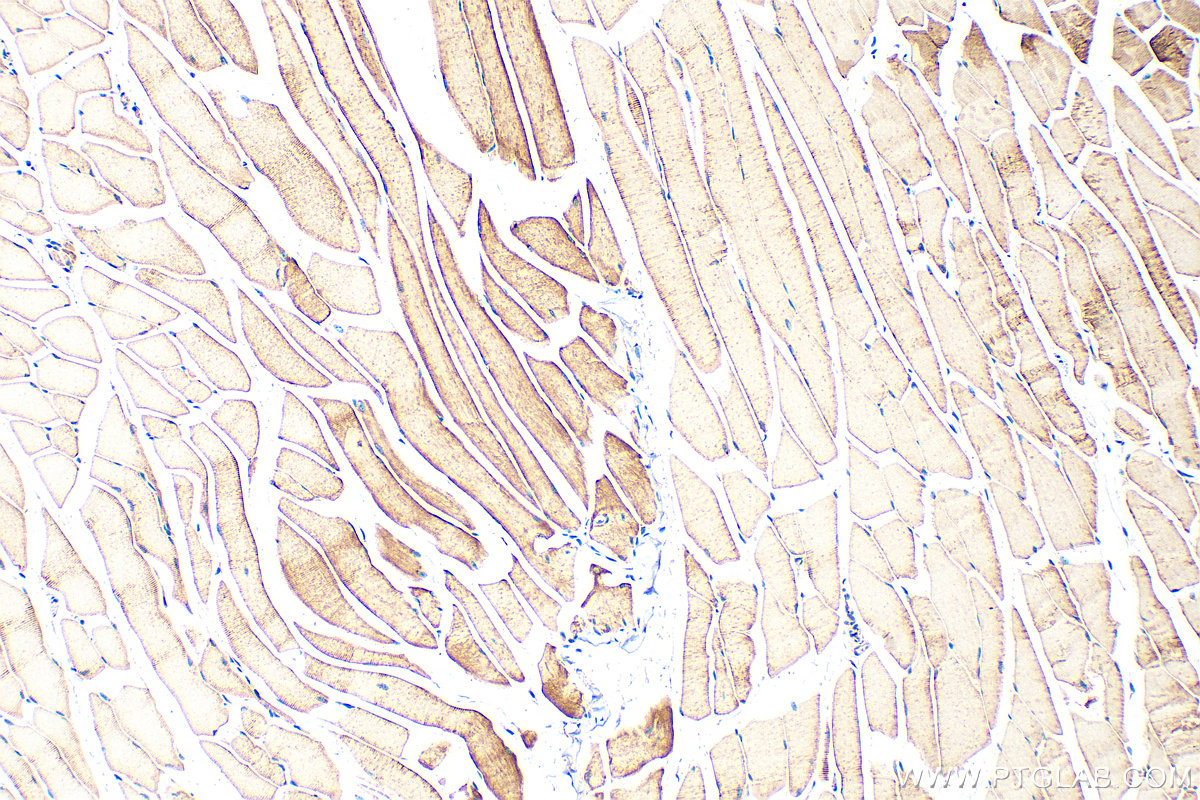 Immunohistochemistry (IHC) staining of mouse skeletal muscle tissue using PFKM Polyclonal antibody (55028-1-AP)