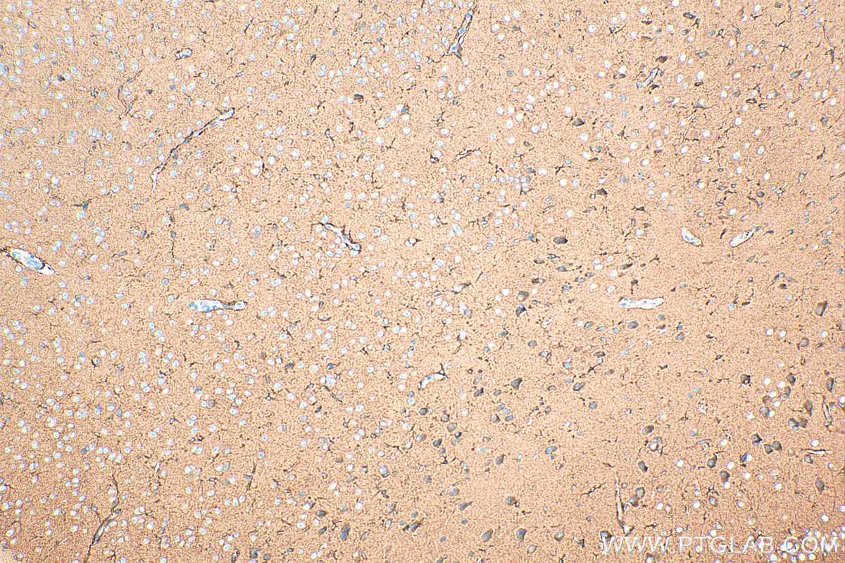 Immunohistochemistry (IHC) staining of mouse brain tissue using PFKM Polyclonal antibody (55028-1-AP)
