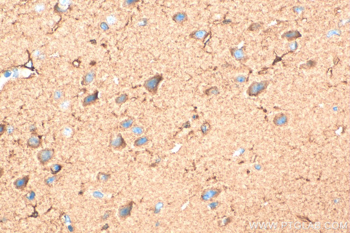 Immunohistochemistry (IHC) staining of mouse brain tissue using PFKM Polyclonal antibody (55028-1-AP)