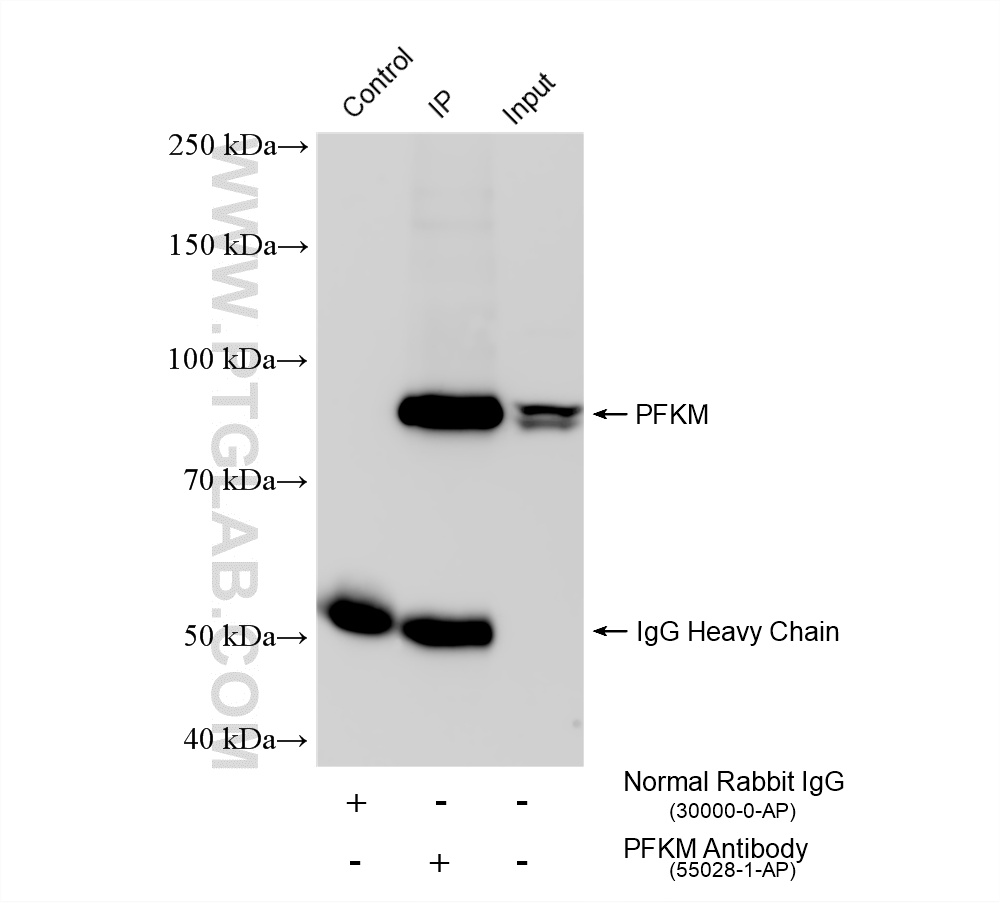 Immunoprecipitation (IP) experiment of mouse liver tissue using PFKM Polyclonal antibody (55028-1-AP)