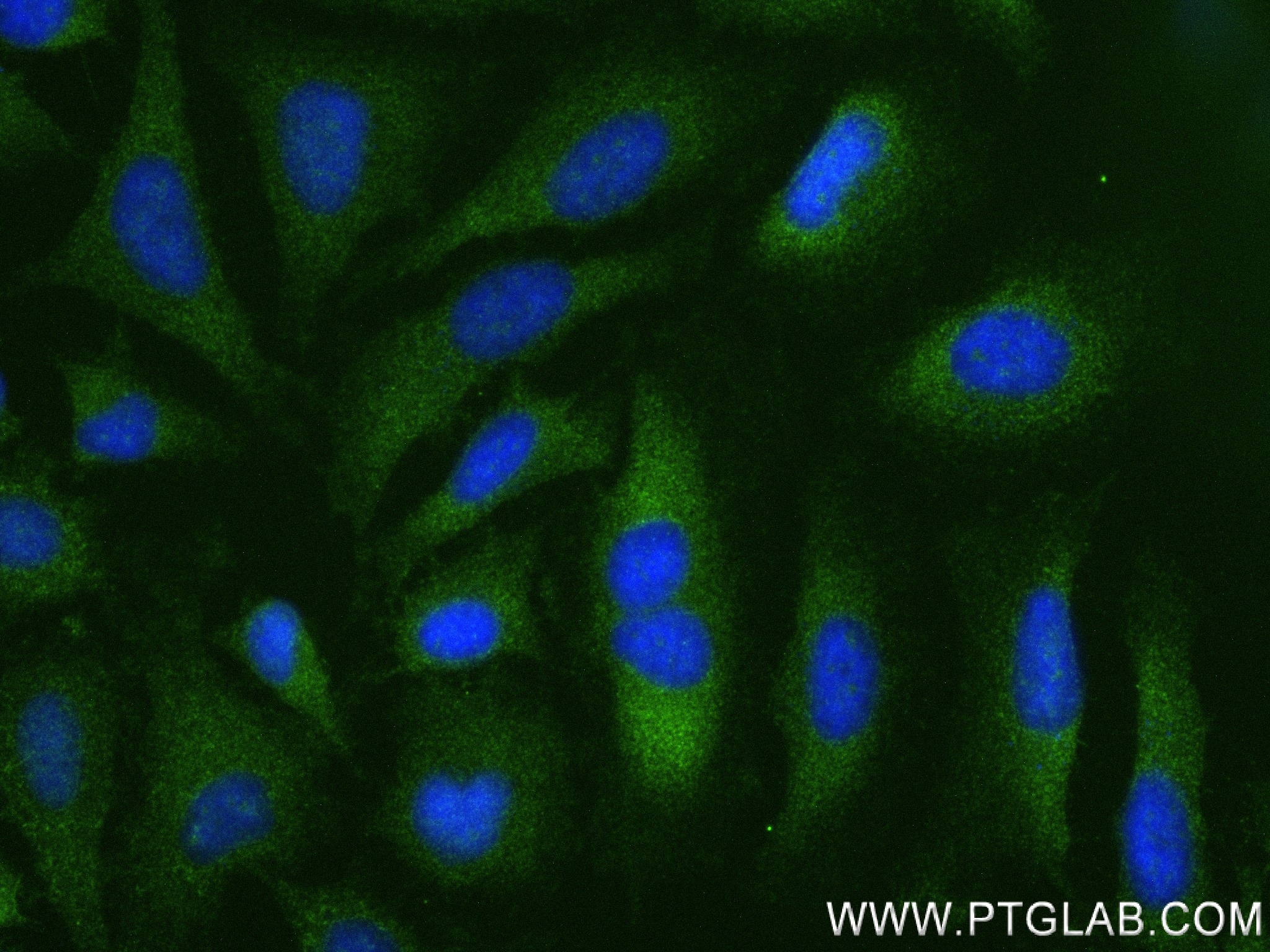 Immunofluorescence (IF) / fluorescent staining of HeLa cells using PFKM Recombinant antibody (84281-5-RR)