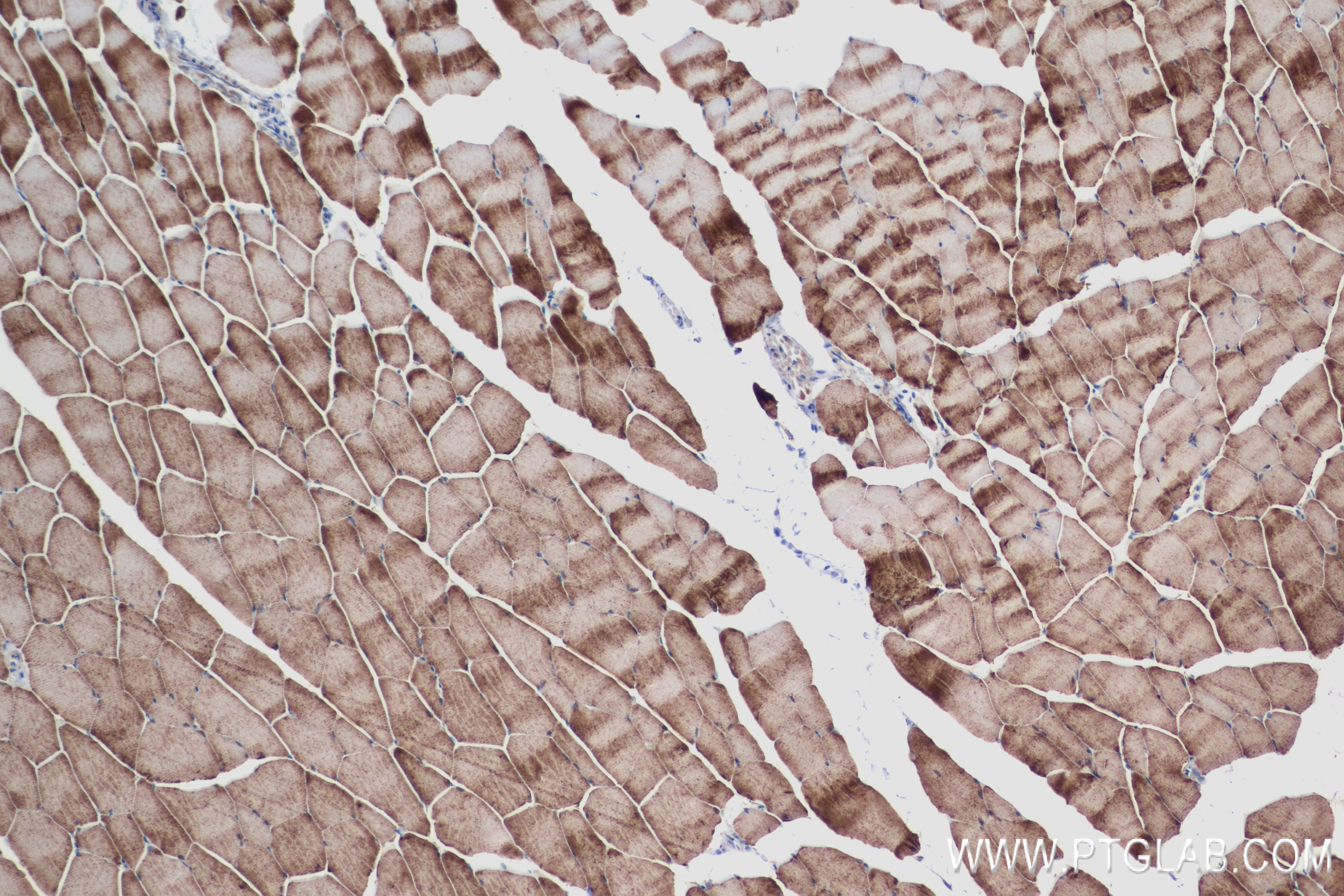 Immunohistochemistry (IHC) staining of mouse skeletal muscle tissue using PFKM Recombinant antibody (84281-5-RR)