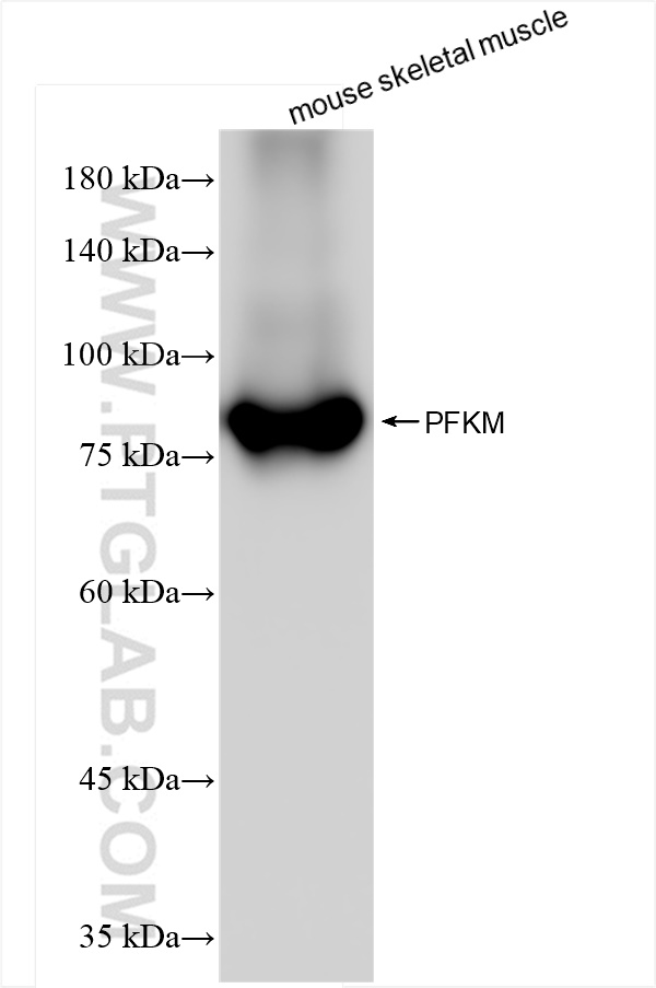 Western Blot (WB) analysis of mouse skeletal muscle tissue using PFKM Recombinant antibody (84281-5-RR)