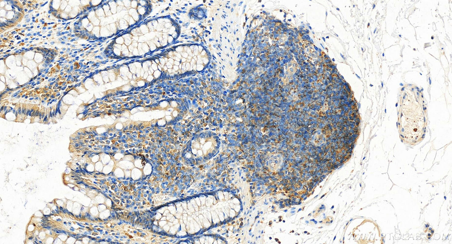 Immunohistochemistry (IHC) staining of human normal colon using Profilin 1 Polyclonal antibody (11680-1-AP)