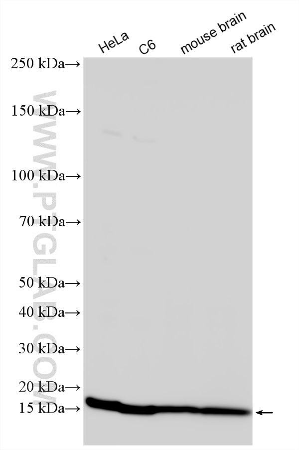 Western Blot (WB) analysis of various lysates using Profilin 1 Polyclonal antibody (11680-1-AP)