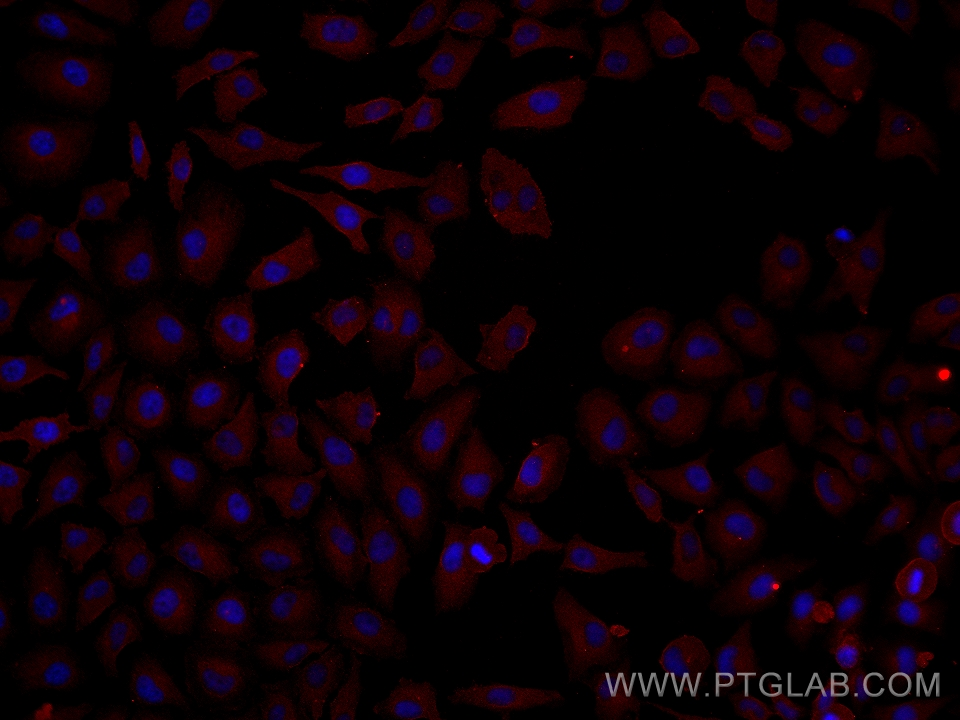 Immunofluorescence (IF) / fluorescent staining of HeLa cells using PFN2 Monoclonal antibody (60094-2-Ig)