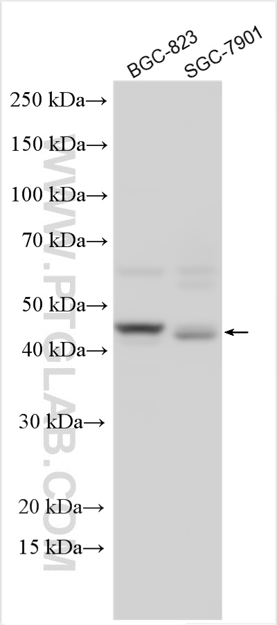 Western Blot (WB) analysis of various lysates using Pepsinogen I Polyclonal antibody (17330-1-AP)