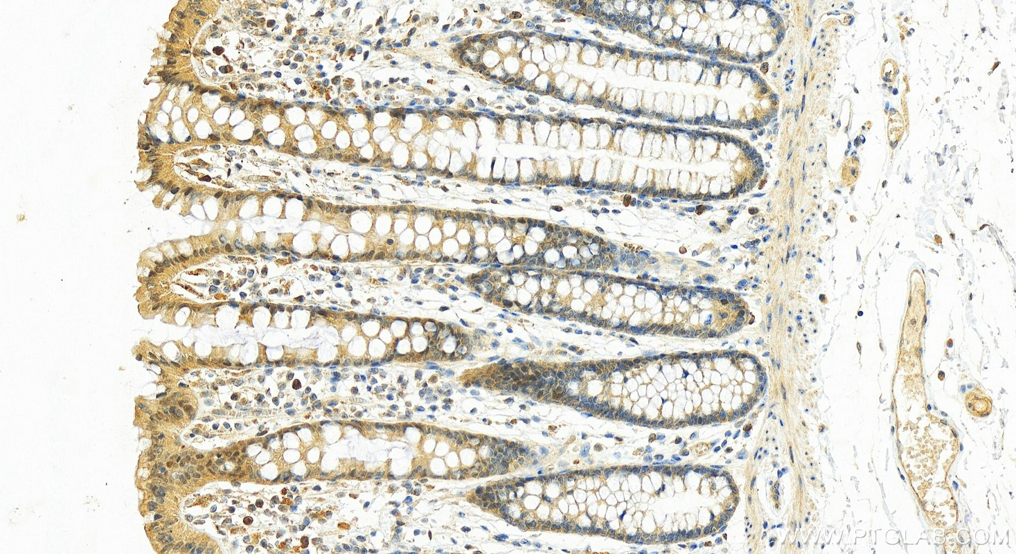 Immunohistochemistry (IHC) staining of human normal colon using PGAM1 Polyclonal antibody (16126-1-AP)