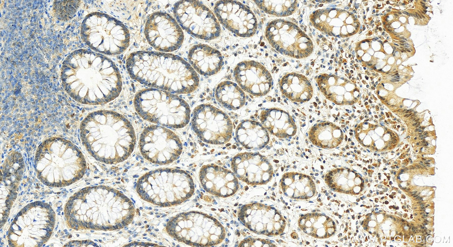 Immunohistochemistry (IHC) staining of human normal colon using PGAM1 Polyclonal antibody (16126-1-AP)