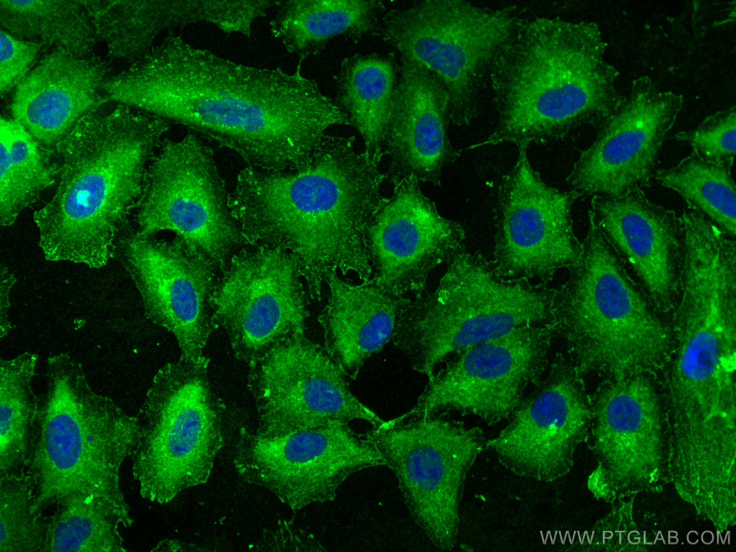 Immunofluorescence (IF) / fluorescent staining of A549 cells using PGAM1 Polyclonal antibody (16126-1-AP)