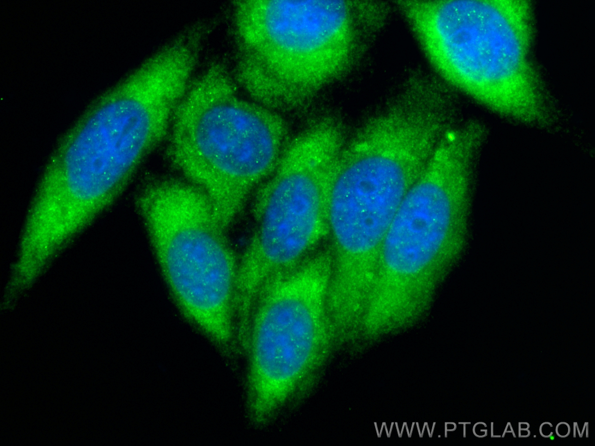 Immunofluorescence (IF) / fluorescent staining of HepG2 cells using PGBD1 Polyclonal antibody (25539-1-AP)