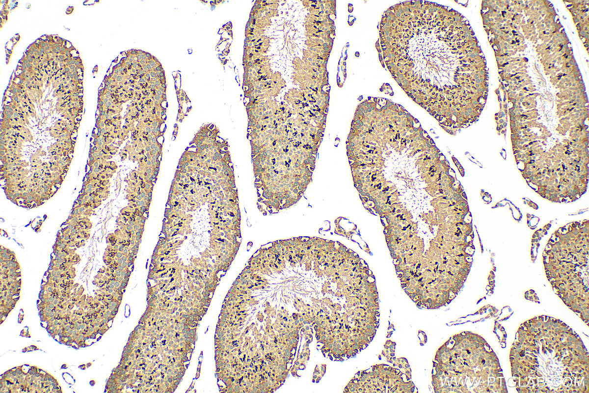 Immunohistochemistry (IHC) staining of mouse testis tissue using PGBD1 Polyclonal antibody (25539-1-AP)