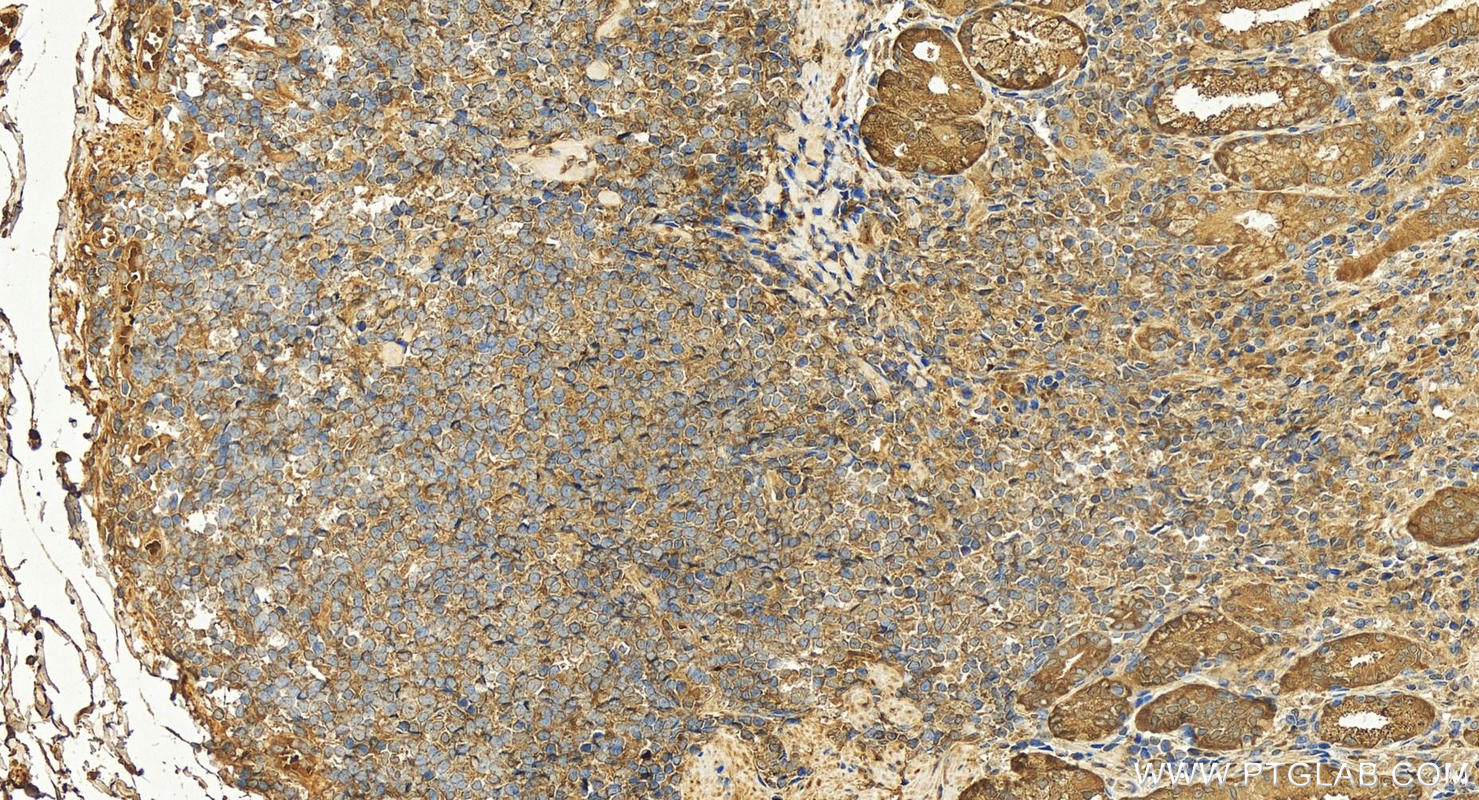 Immunohistochemistry (IHC) staining of human stomach tissue using PGC Polyclonal antibody (28532-1-AP)