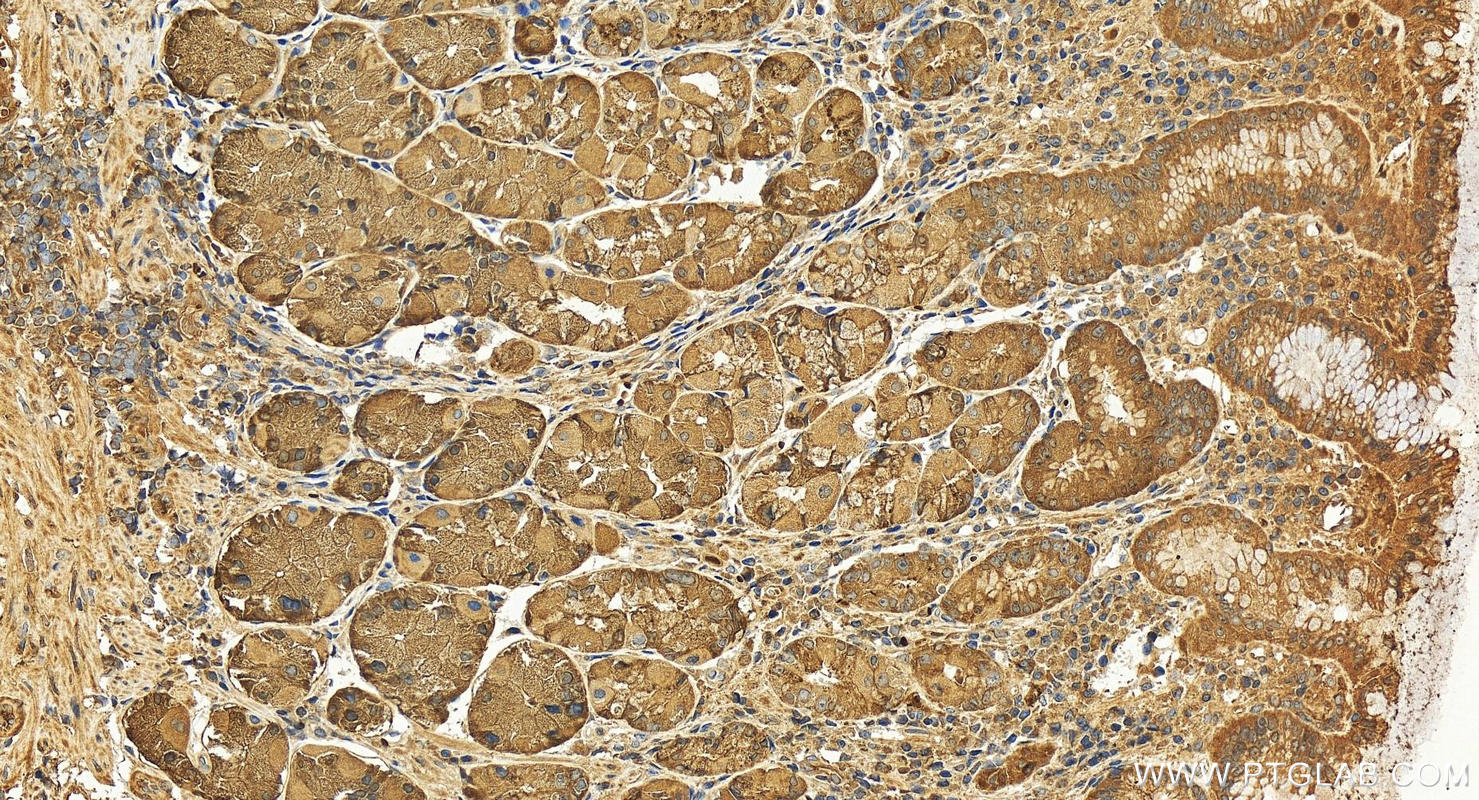 Immunohistochemistry (IHC) staining of human stomach tissue using PGC Polyclonal antibody (28532-1-AP)