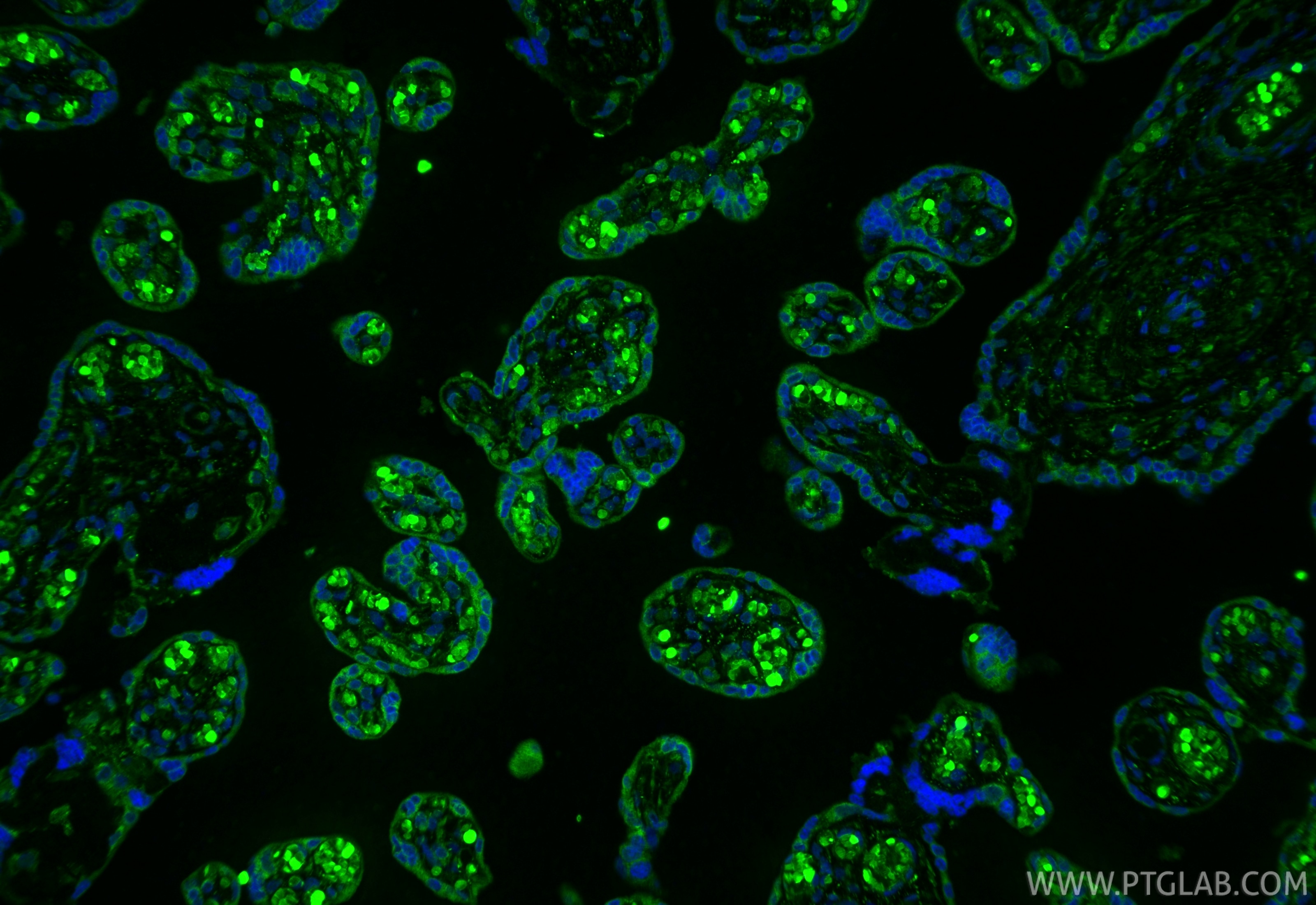 Immunofluorescence (IF) / fluorescent staining of human placenta tissue using PGF/PLGF Polyclonal antibody (10642-1-AP)