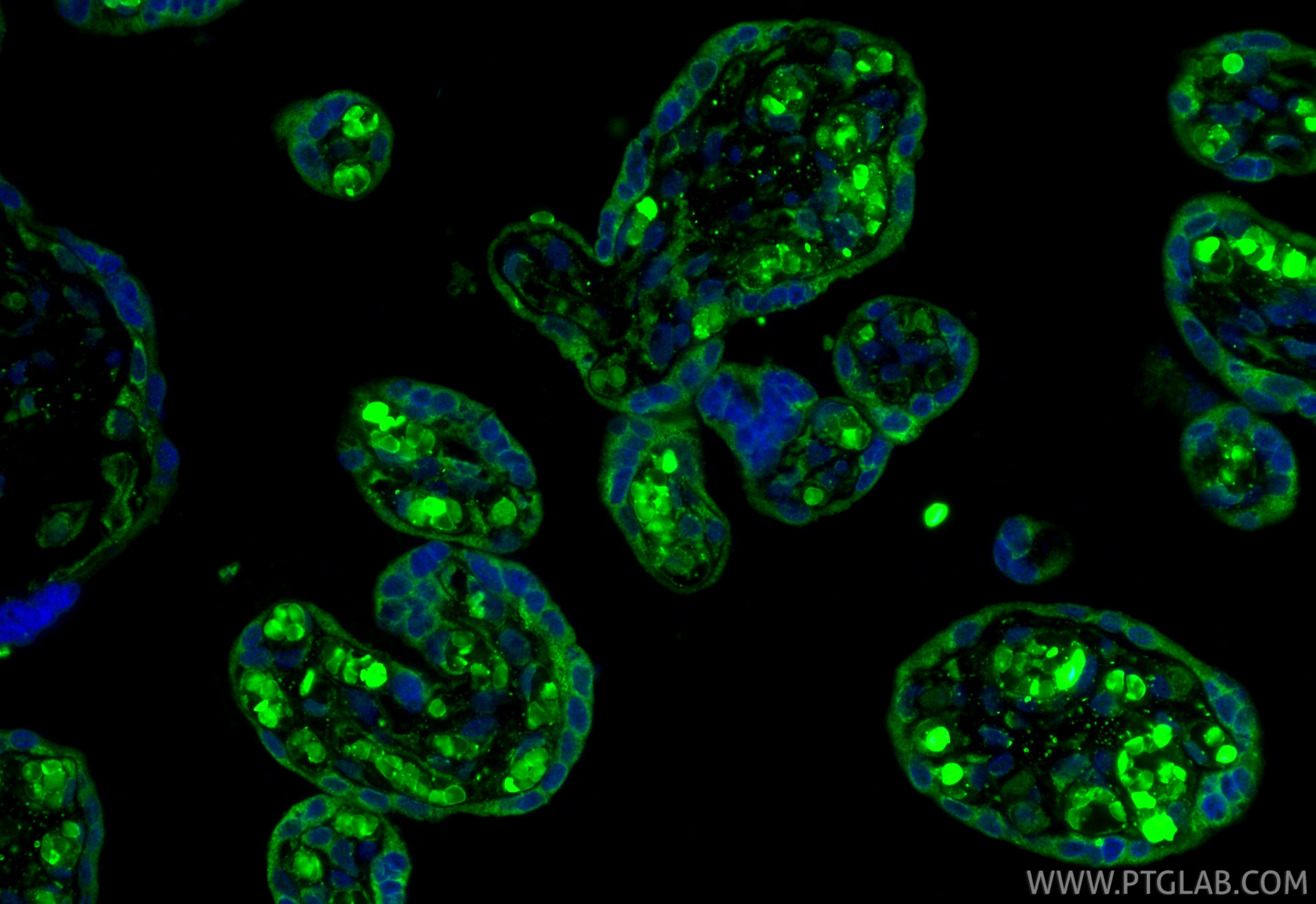 Immunofluorescence (IF) / fluorescent staining of human placenta tissue using PGF/PLGF Polyclonal antibody (10642-1-AP)