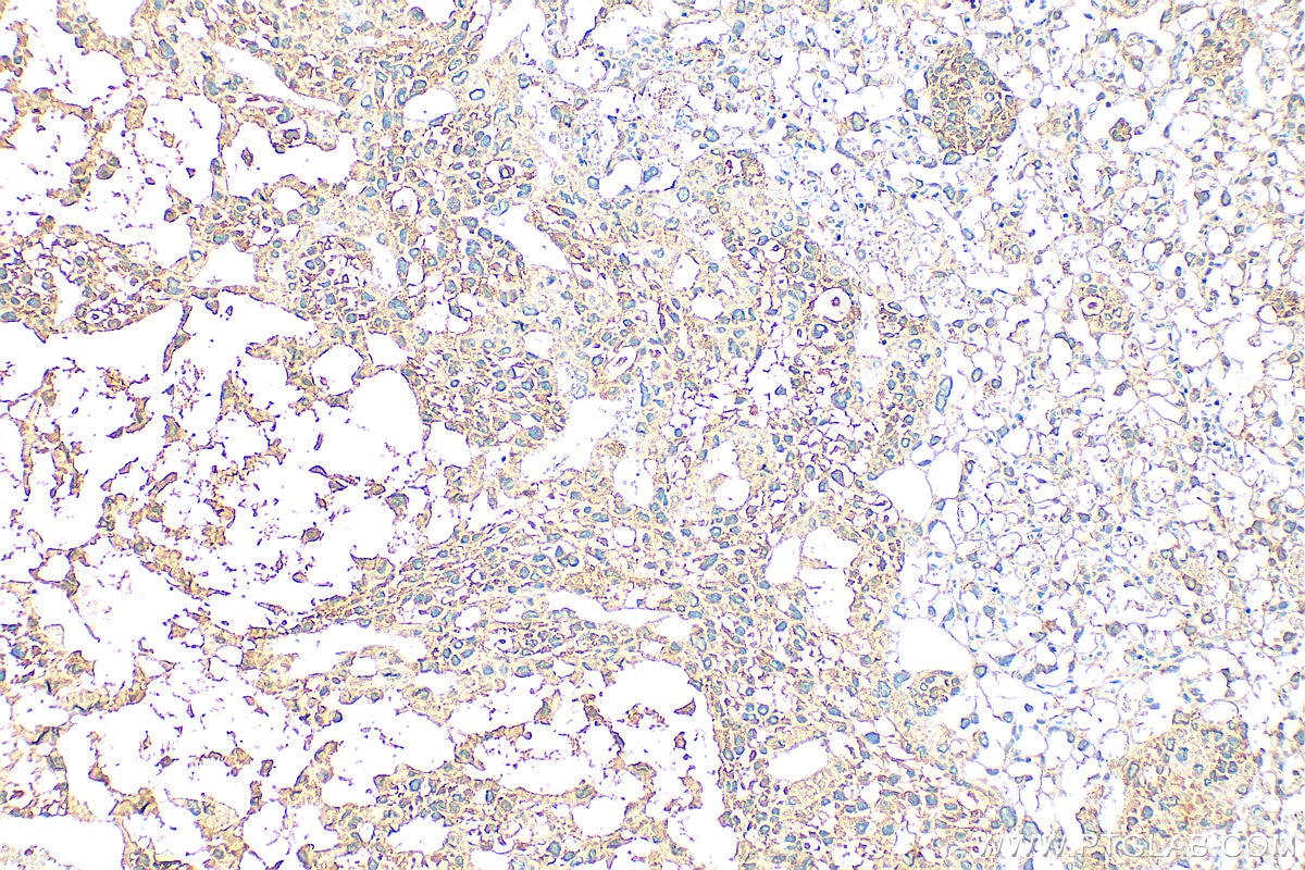 Immunohistochemistry (IHC) staining of mouse placenta tissue using PGF/PLGF Polyclonal antibody (10642-1-AP)