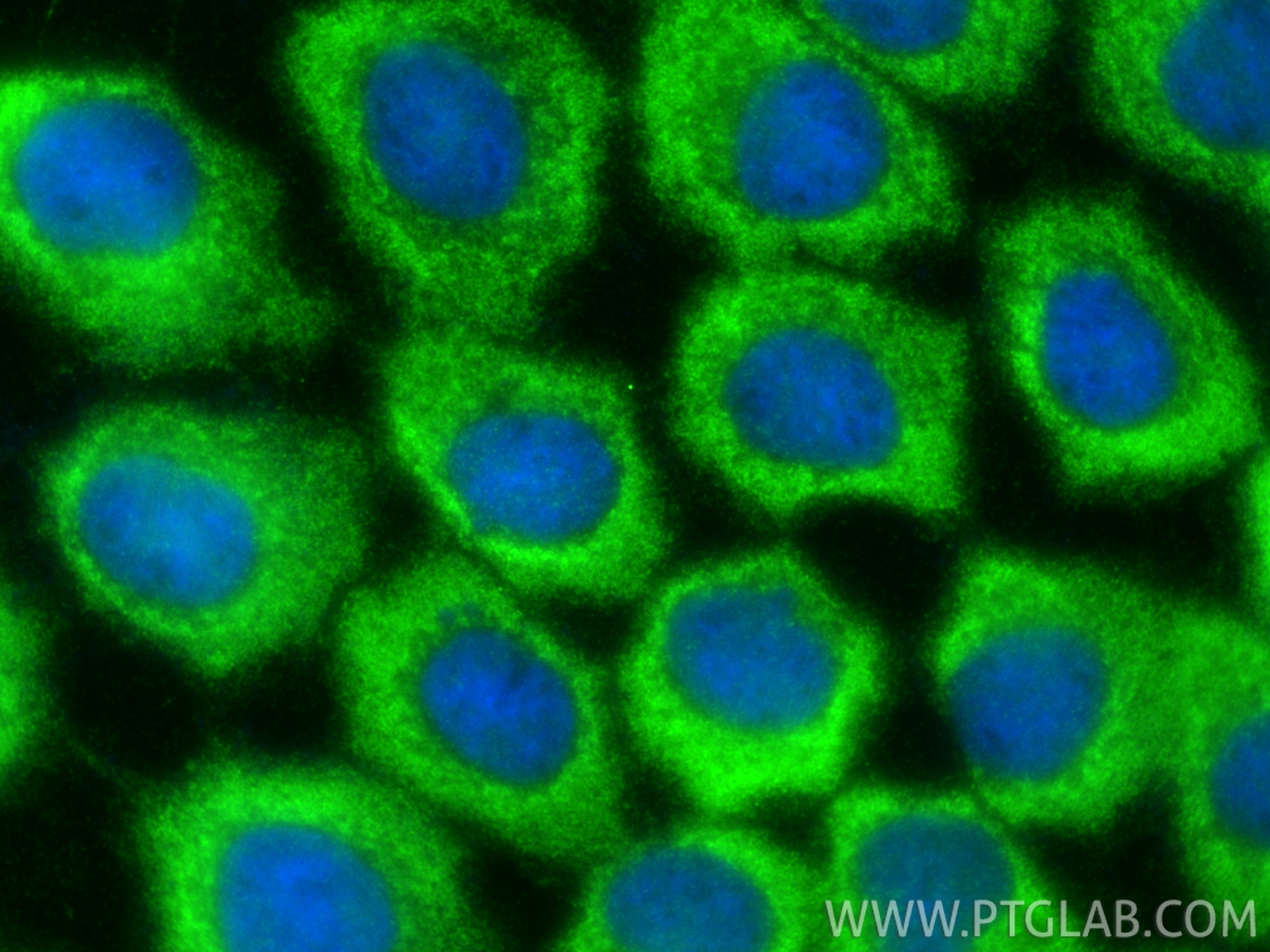 Immunofluorescence (IF) / fluorescent staining of A431 cells using PGK1 Polyclonal antibody (17811-1-AP)