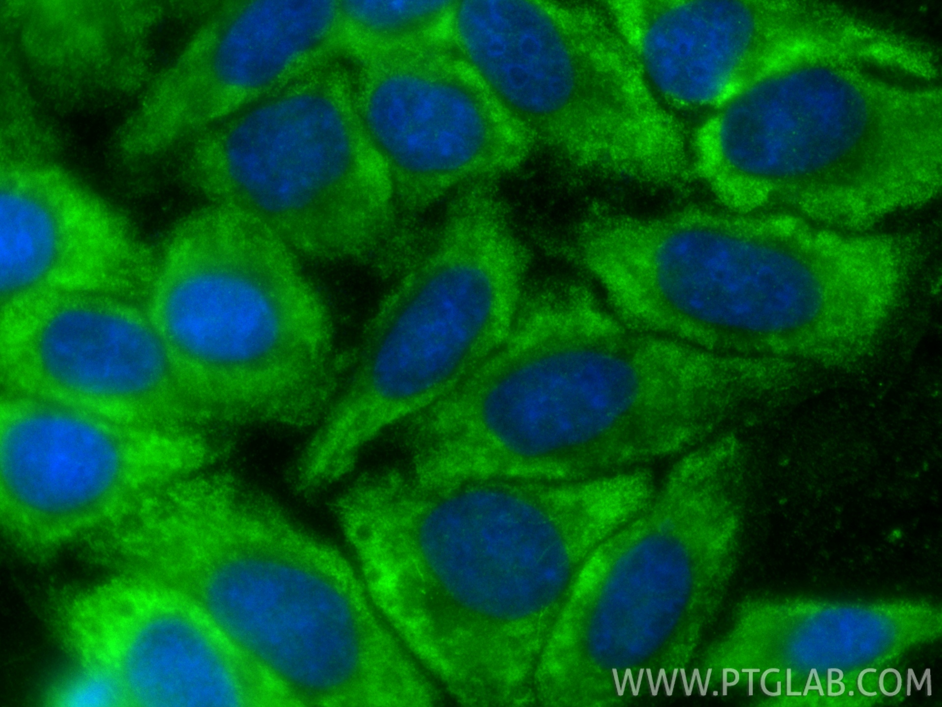 Immunofluorescence (IF) / fluorescent staining of HepG2 cells using PGK1 Polyclonal antibody (17811-1-AP)