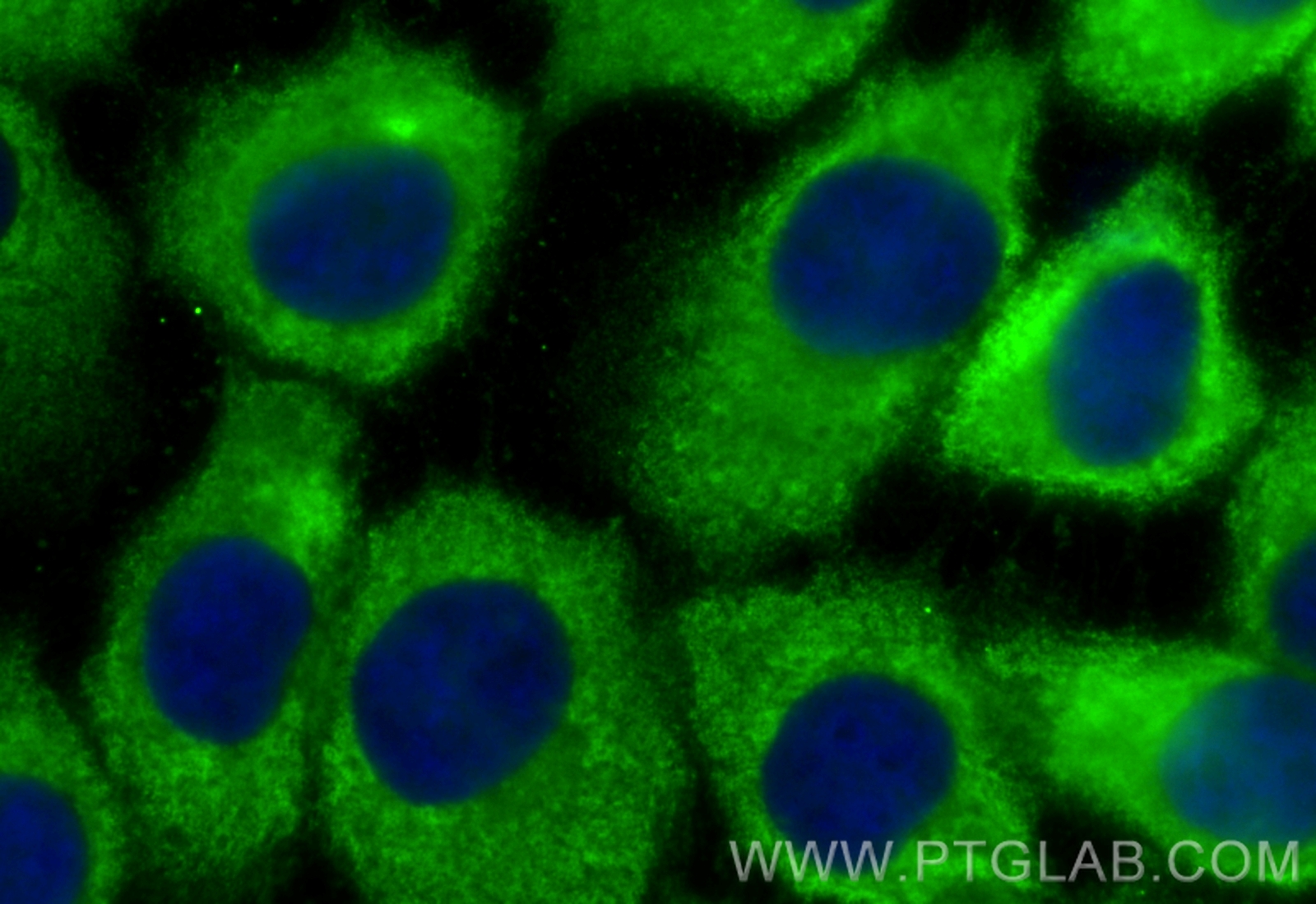 Immunofluorescence (IF) / fluorescent staining of A431 cells using PGK1 Monoclonal antibody (68035-1-Ig)