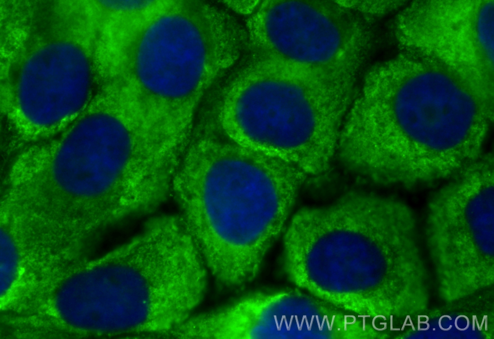 Immunofluorescence (IF) / fluorescent staining of A431 cells using CoraLite® Plus 488-conjugated PGK1 Monoclonal anti (CL488-68035)