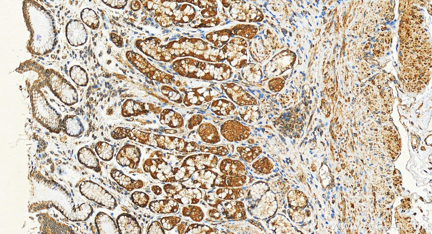 Immunohistochemistry (IHC) staining of human stomach tissue using PGM5 Recombinant antibody (82965-1-RR)