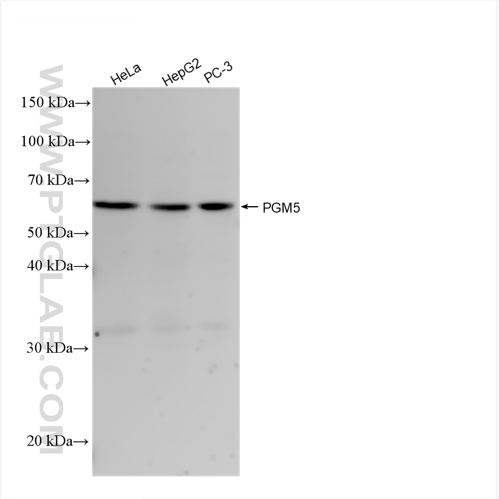 Western Blot (WB) analysis of various lysates using PGM5 Recombinant antibody (82965-1-RR)