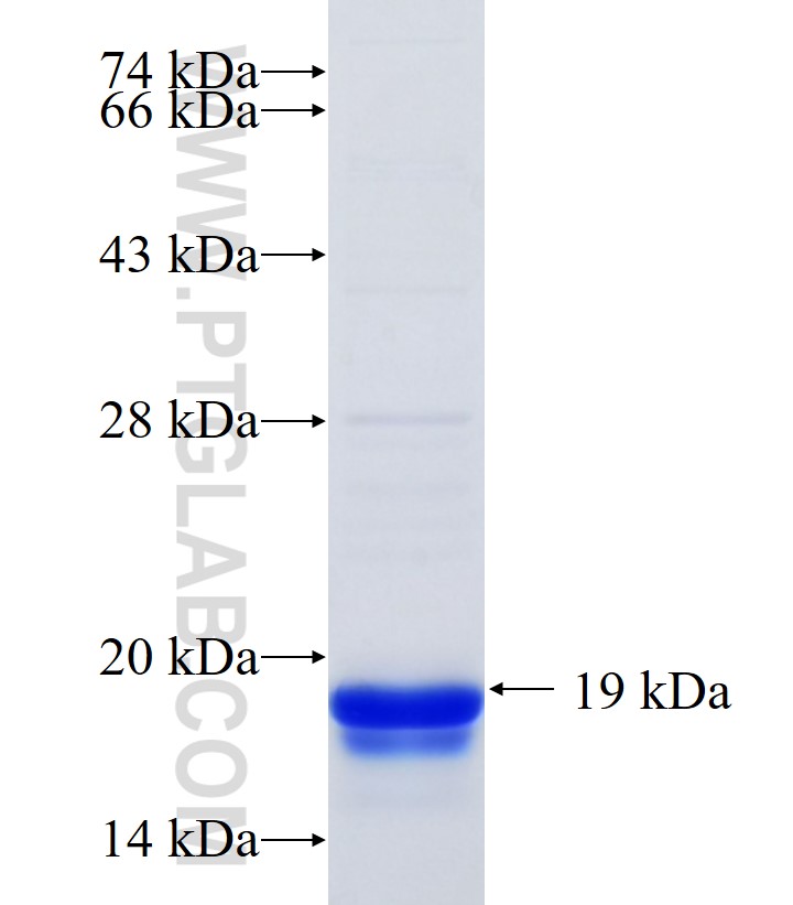 PGM5 fusion protein Ag34399 SDS-PAGE