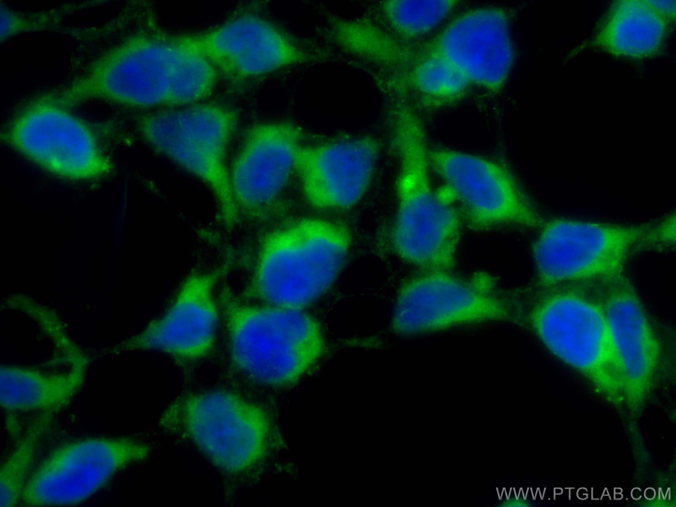 Immunofluorescence (IF) / fluorescent staining of HEK-293 cells using PGRMC1 Polyclonal antibody (12990-1-AP)