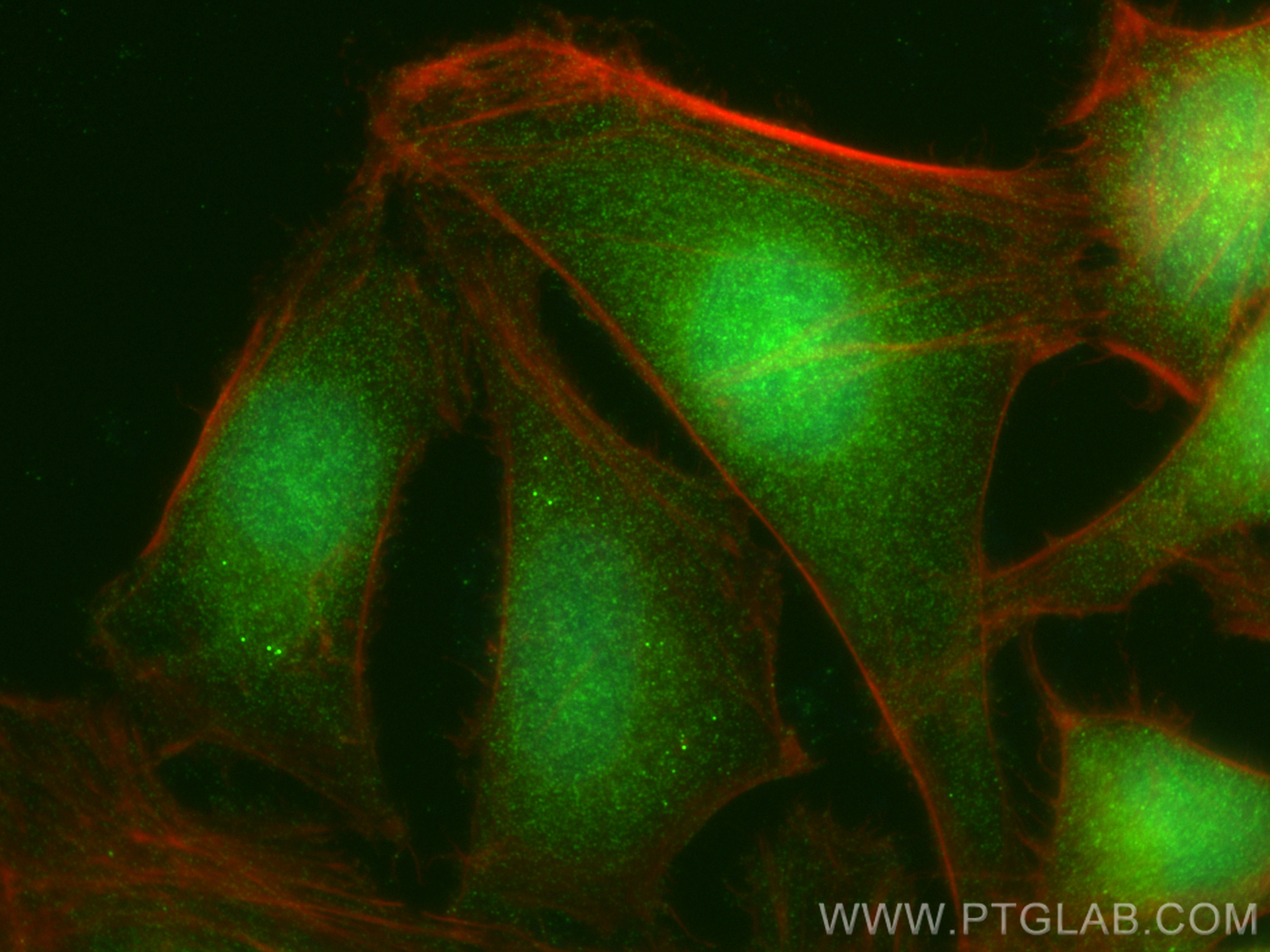 Immunofluorescence (IF) / fluorescent staining of HeLa cells using PGRMC2 Polyclonal antibody (24575-1-AP)