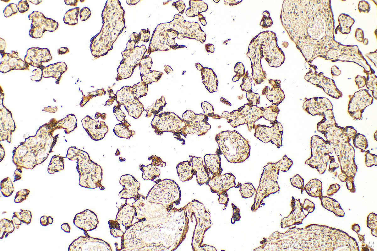 Immunohistochemistry (IHC) staining of human placenta tissue using PGRMC2 Polyclonal antibody (24575-1-AP)