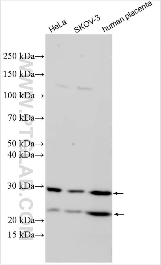 Western Blot (WB) analysis of various lysates using PGRMC2 Polyclonal antibody (24575-1-AP)