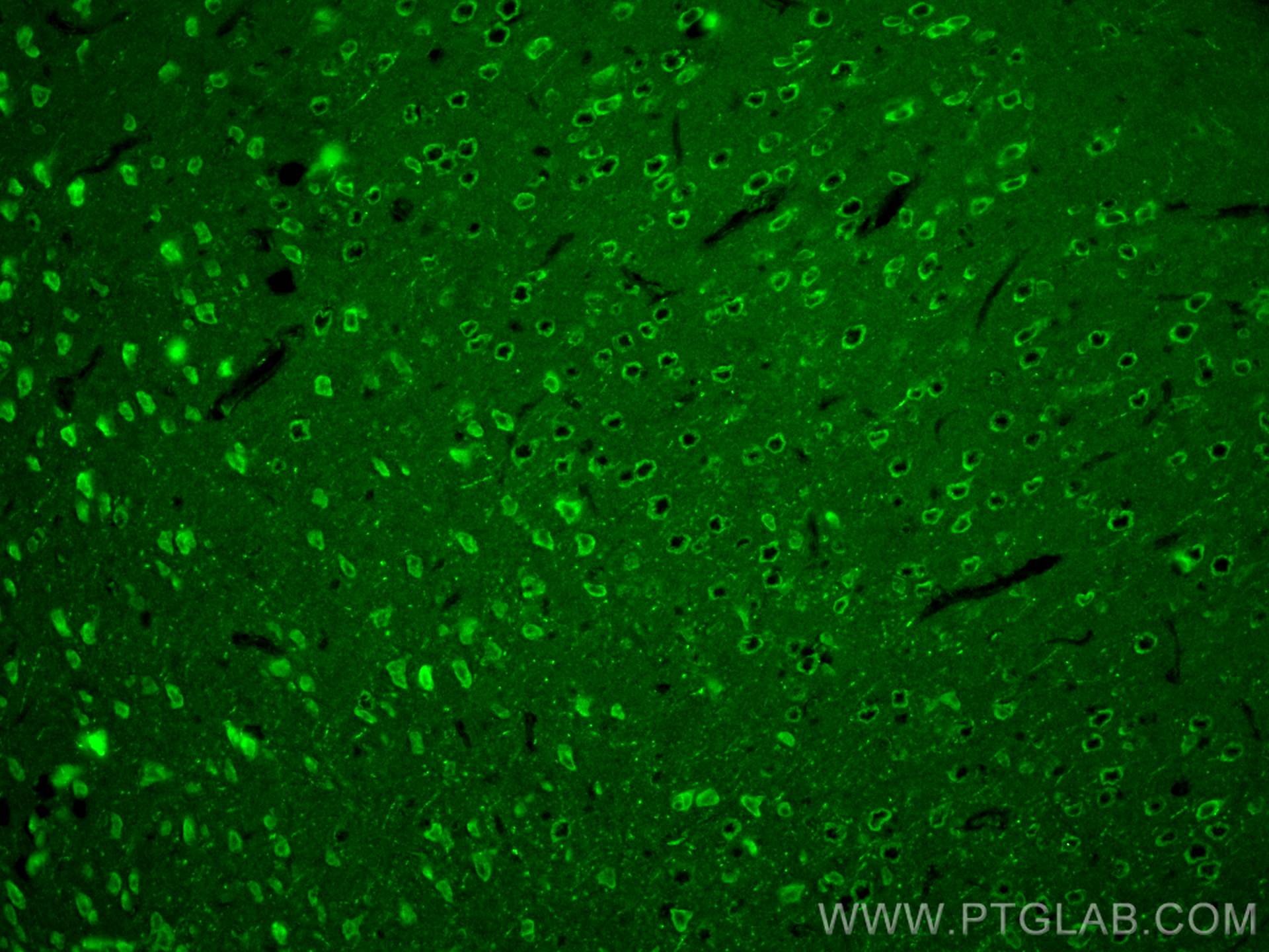 Immunofluorescence (IF) / fluorescent staining of mouse brain tissue using PHACTR1 Polyclonal antibody (23446-1-AP)