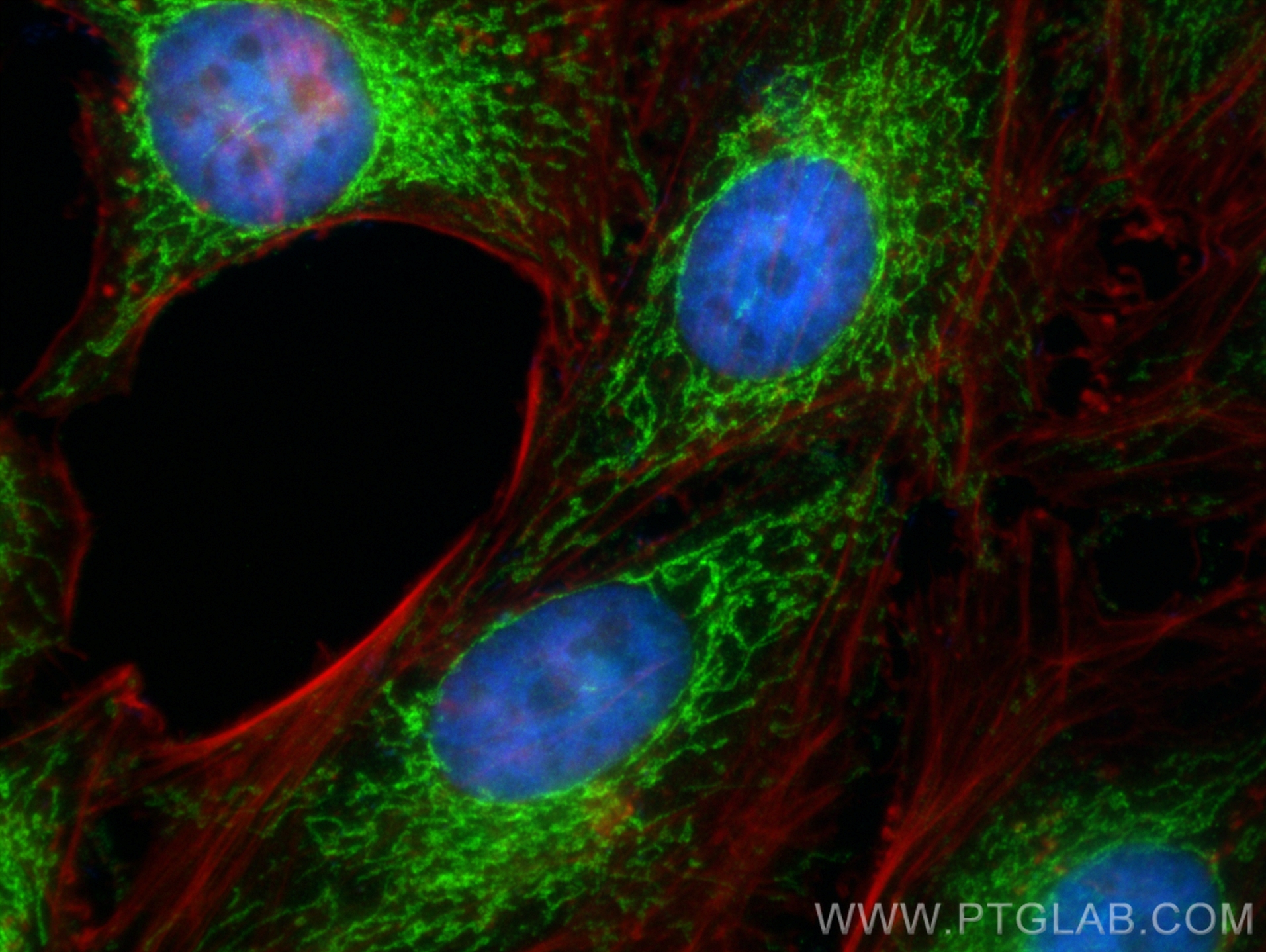 Immunofluorescence (IF) / fluorescent staining of HeLa cells using Prohibitin Polyclonal antibody (10787-1-AP)