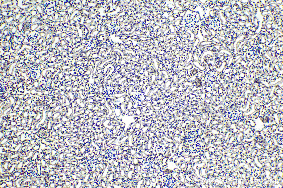 Immunohistochemistry (IHC) staining of mouse kidney tissue using PHC2 Polyclonal antibody (12867-1-AP)