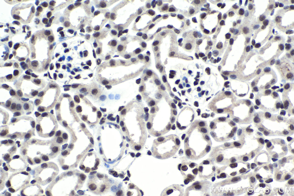 Immunohistochemistry (IHC) staining of mouse kidney tissue using PHC2 Polyclonal antibody (12867-1-AP)