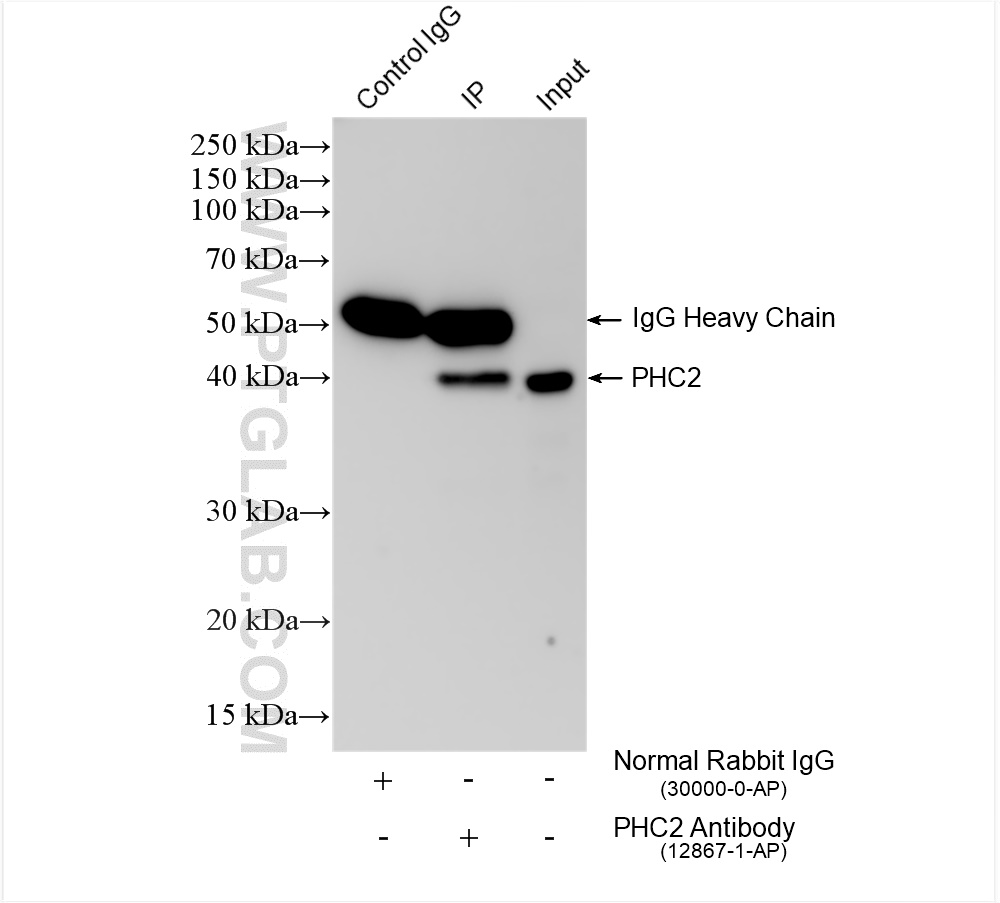 Immunoprecipitation (IP) experiment of HL-60 cells using PHC2 Polyclonal antibody (12867-1-AP)