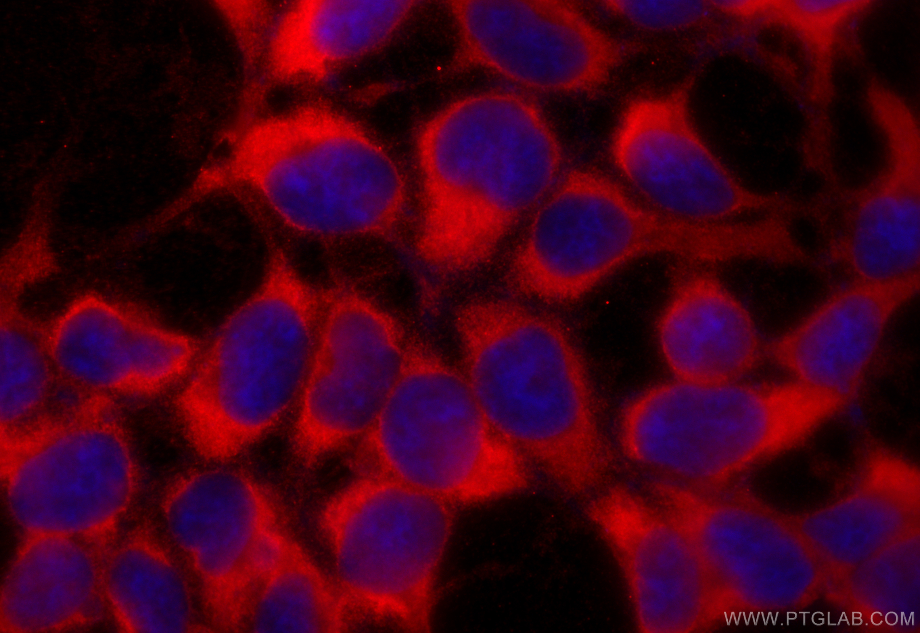 Immunofluorescence (IF) / fluorescent staining of HEK-293 cells using CoraLite®594-conjugated PHD2/EGLN1 Monoclonal anti (CL594-66589)