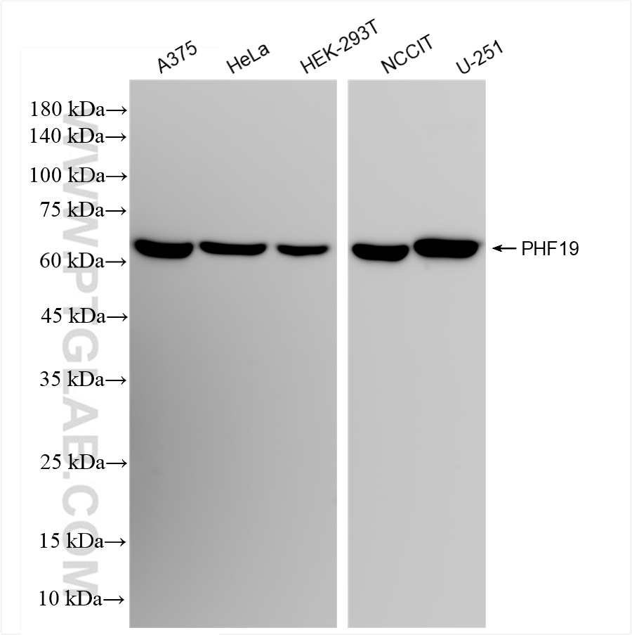 Western Blot (WB) analysis of various lysates using PHF19 Recombinant antibody (83892-3-RR)