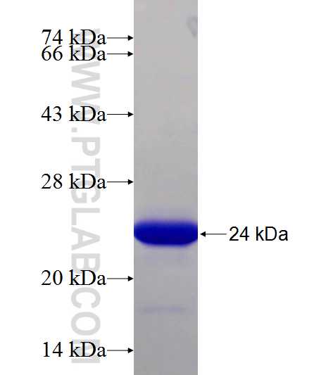 PHF20L1 fusion protein Ag25869 SDS-PAGE