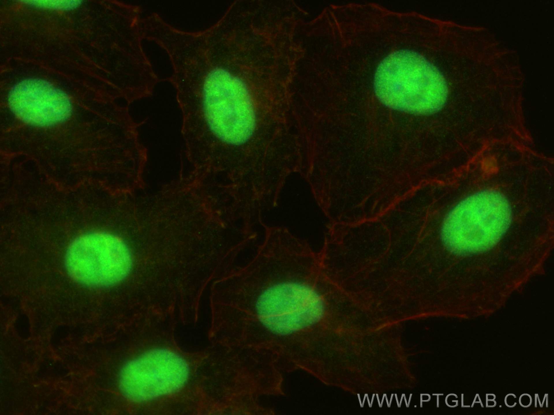 Immunofluorescence (IF) / fluorescent staining of A549 cells using PHF23 Polyclonal antibody (25862-1-AP)